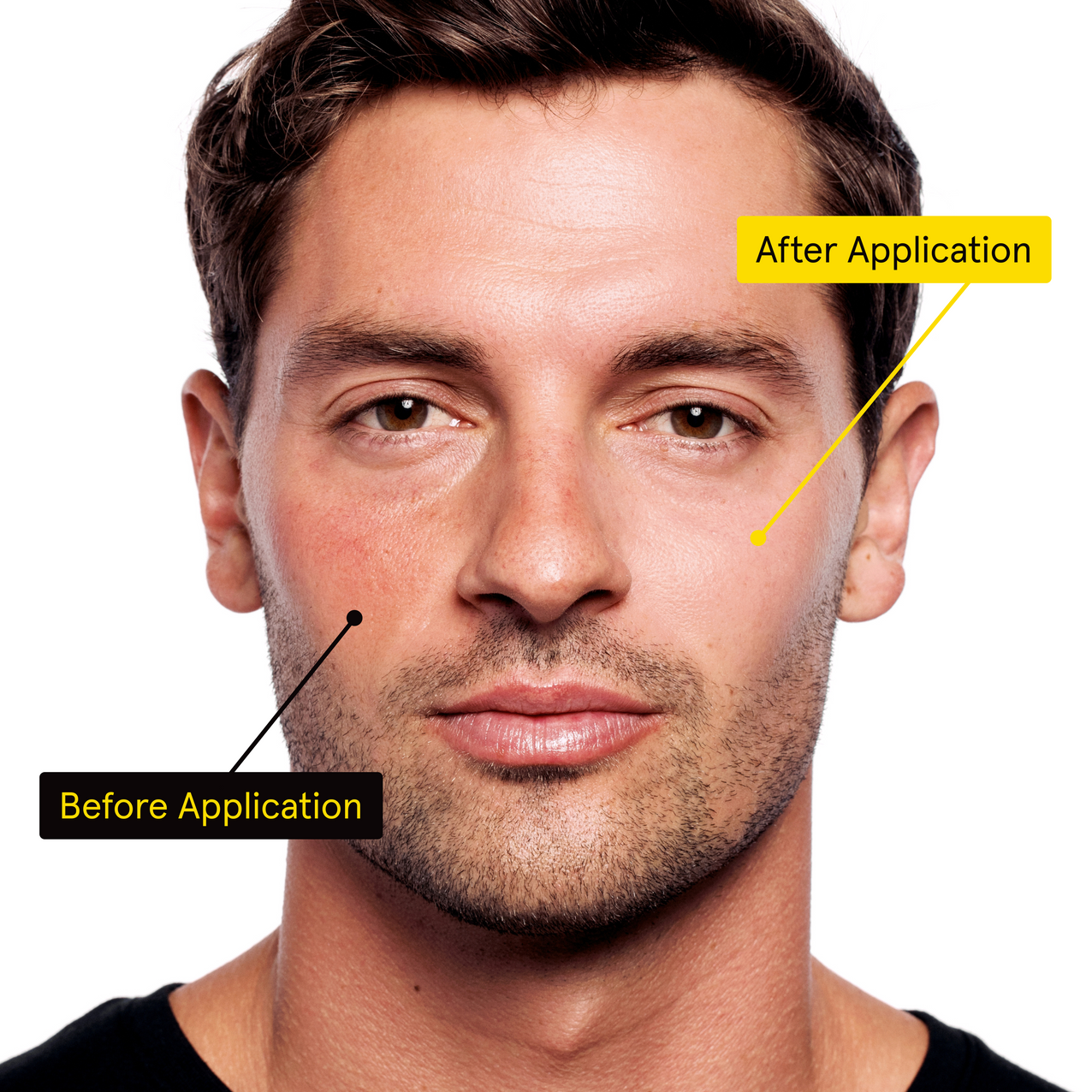 lumin pdp irc before after